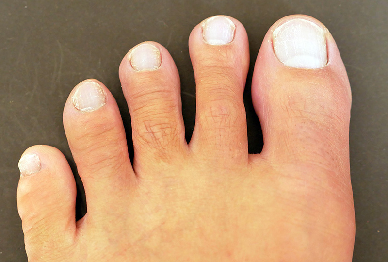 足 の 親指 が 痛い 足の親指の付け根が痛い女性は必見！女性に多い原因と対処法を大公開！